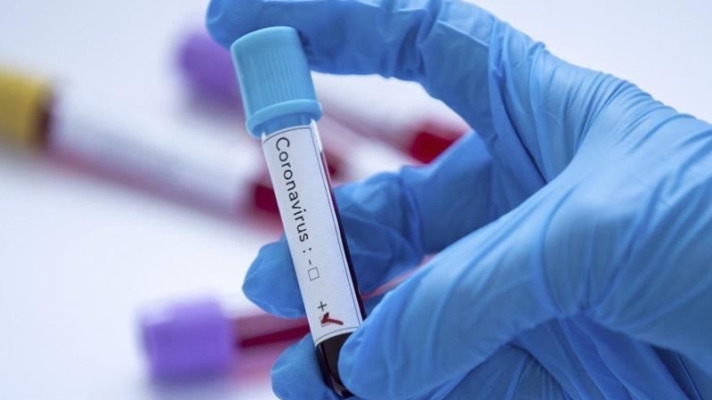 Nobelli Fransız Doktor: Koronavirüs laboratuarda üretildi