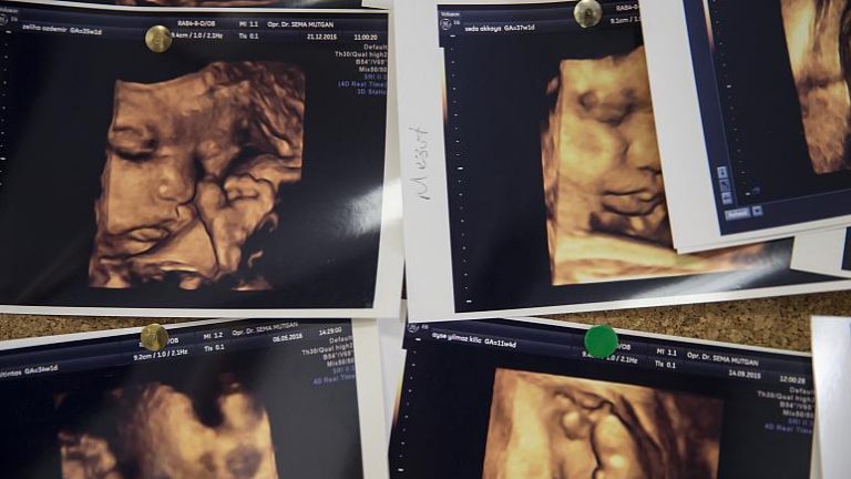 Doğurganlık hızında Romanya’nın gerisine düştük