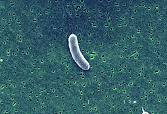 Karadeniz kıyılarında Vibrio alarmı: Uzmanlardan turistlere kritik uyarılar