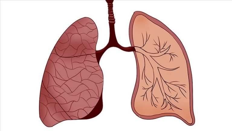 Mikroplastik, insan kanından sonra bu kez de akciğerde tespit edildi